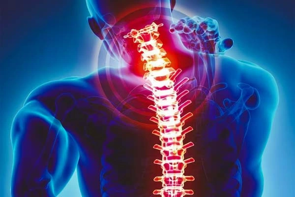 Cervical Pain