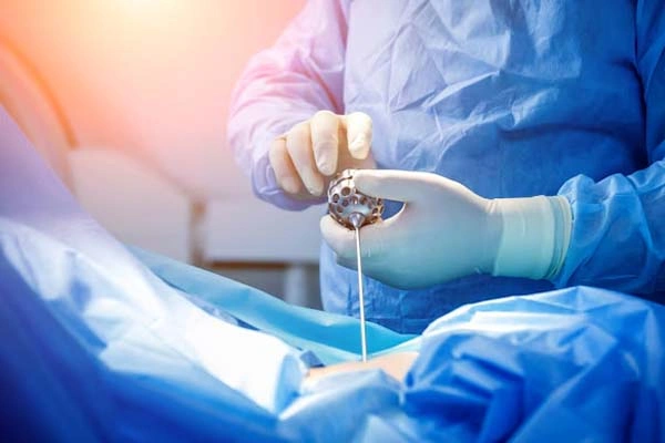 Microdiscectomy